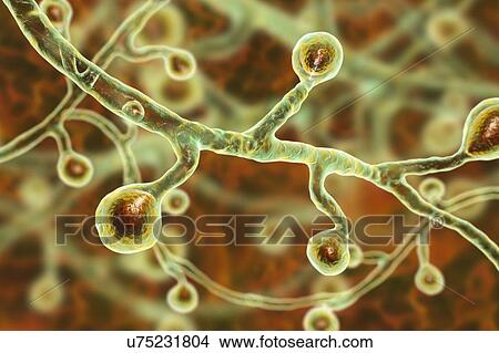 Picture - Blastomyces dermatitidis fungus, computer illustration. This fungus is the causative agent of the disease blastomycosis, which has a range of presentations. It mainly affects the lungs and may cause a flu-like disease, an acute disease similar to.... Fotosearch