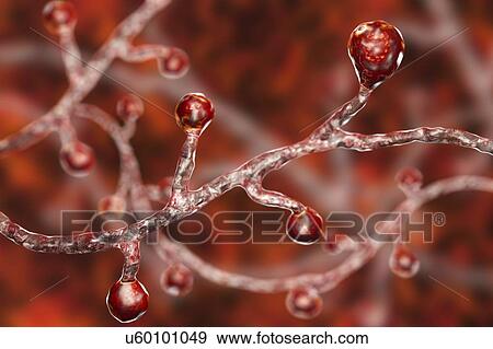 Stock Photo - Blastomyces dermatitidis fungus, computer illustration. This fungus is the causative agent of the disease blastomycosis, which has a range of presentations. It mainly affects the lungs and may cause a flu-like disease, an acute disease similar to.... Fotosearch