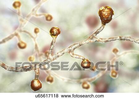 Blastomyces dermatitidis fungus, computer illustration. This fungus is the causative agent of the disease blastomycosis, which has a range of presentations. It mainly affects the lungs and may cause a flu-like disease, an acute disease similar to... View Large Photo Image Stock Photo - Blastomyces dermatitidis fungus, computer illustration. This fungus is the causative agent of the disease blastomycosis, which has a range of presentations. It mainly affects the lungs and may cause a flu-like disease, an acute disease similar to.... Fotosearch