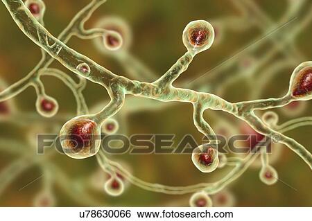 Stock Photograph - Blastomyces dermatitidis fungus, computer illustration. This fungus is the causative agent of the disease blastomycosis, which has a range of presentations. It mainly affects the lungs and may cause a flu-like disease, an acute disease similar to.... Fotosearch