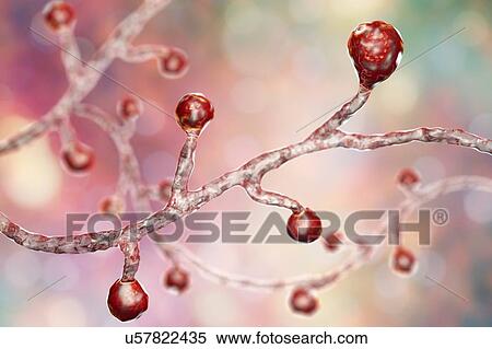 Blastomyces dermatitidis fungus, computer illustration. This fungus is the causative agent of the disease blastomycosis, which has a range of presentations. It mainly affects the lungs and may cause a flu-like disease, an acute disease similar to... View Large Photo Image Stock Photography - Blastomyces dermatitidis fungus, computer illustration. This fungus is the causative agent of the disease blastomycosis, which has a range of presentations. It mainly affects the lungs and may cause a flu-like disease, an acute disease similar to.... Fotosearch