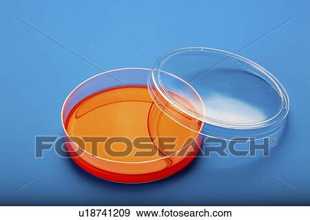 Stock Photo - Blood agar in Petri dish.. Fotosearch