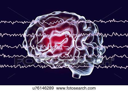 Stock Photo - Brain and active brain waves, computer illustration. An electroencephalogram (EEG) measures electrical activity in the brain using electrodes attached to the scalp. Various disorders can be diagnosed by analysing EEG results.. Fotosearch
