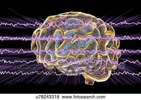 Stock Photo - Brain and active brain waves, computer illustration. An electroencephalogram (EEG) measures electrical activity in the brain using electrodes attached to the scalp. Various disorders can be diagnosed by analysing EEG results.. Fotosearch