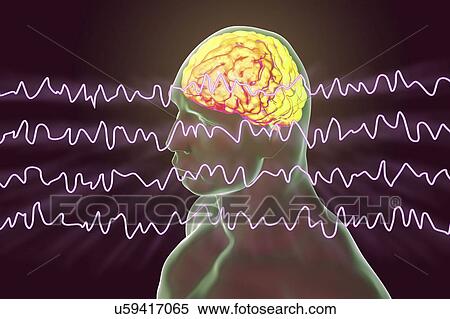 Stock Photography - Brain and brain waves in awake state during rest, computer illustration. An electroencephalogram (EEG) measures electrical activity in the brain using electrodes attached to the scalp. Various disorders can be diagnosed by analysing EEG results.. Fotosearch