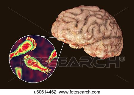 Stock Image - Brain-eating amoeba infection. Computer illustration of Naegleria fowleri protozoans infecting the brain. This organism is an opportunistic pathogen of humans, causing meningoencephalitis (inflammation of the brain and its surrounding membranes) when.... Fotosearch