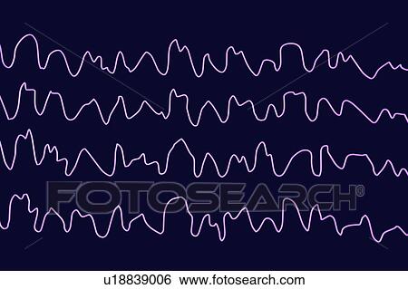 Stock Photograph - Brain waves during sleeping, computer illustration. An electroencephalogram (EEG) measures electrical activity in the brain using electrodes attached to the scalp. Various disorders can be diagnosed by analysing EEG results.. Fotosearch