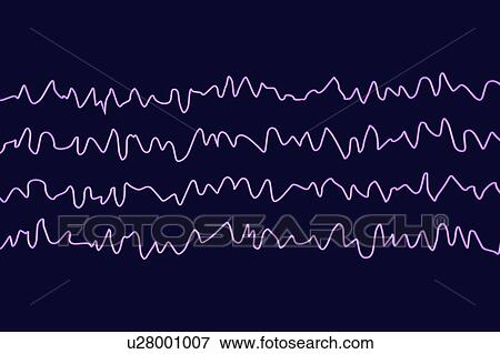 Stock Photo - Brain waves in awake state during rest, computer illustration. An electroencephalogram (EEG) measures electrical activity in the brain using electrodes attached to the scalp. Various disorders can be diagnosed by analysing EEG results.. Fotosearch