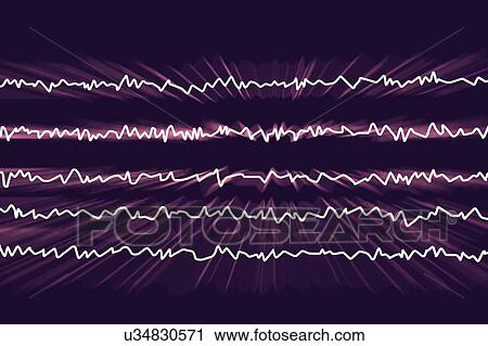 Stock Image - Brain waves in awake state with mental activity, computer illustration. An electroencephalogram (EEG) measures electrical activity in the brain using electrodes attached to the scalp. Various disorders can be diagnosed by analysing EEG results.. Fotosearch