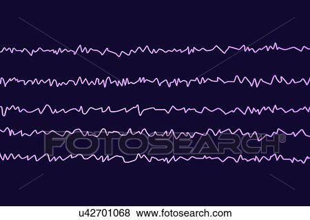 Stock Photo - Brain waves in awake state with mental activity, computer illustration. An electroencephalogram (EEG) measures electrical activity in the brain using electrodes attached to the scalp. Various disorders can be diagnosed by analysing EEG results.. Fotosearch
