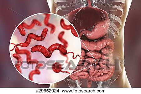Picture - Campylobacteriosis, conceptual illustration. Campylobacter jejuni is a motile, Gram-negative bacterium with a long flagella at one end that is used for locomotion. It can grow in environments where little oxygen is present. It is a common cause of.... Fotosearch