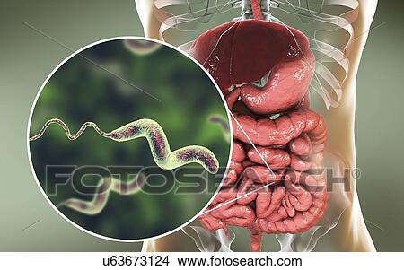 Campylobacteriosis, conceptual illustration. Campylobacter jejuni is a motile, Gram-negative bacterium with a long flagella at one end that is used for locomotion. It can grow in environments where little oxygen is present. It is a common cause of... View Large Photo Image Picture - Campylobacteriosis, conceptual illustration. Campylobacter jejuni is a motile, Gram-negative bacterium with a long flagella at one end that is used for locomotion. It can grow in environments where little oxygen is present. It is a common cause of.... Fotosearch