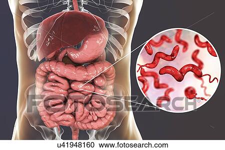 Stock Image - Campylobacteriosis, conceptual illustration. Campylobacter jejuni is a motile, Gram-negative bacterium with a long flagella at one end that is used for locomotion. It can grow in environments where little oxygen is present. It is a common cause of.... Fotosearch