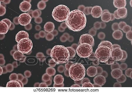 Cancer cells, computer illustration. View Large Photo Image Stock Photo - Cancer cells, computer illustration.. Fotosearch