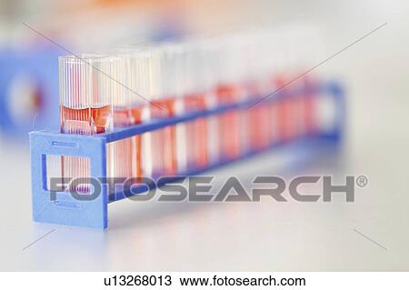 Cell cultures. View Large Photo Image Stock Image - Cell cultures.. Fotosearch