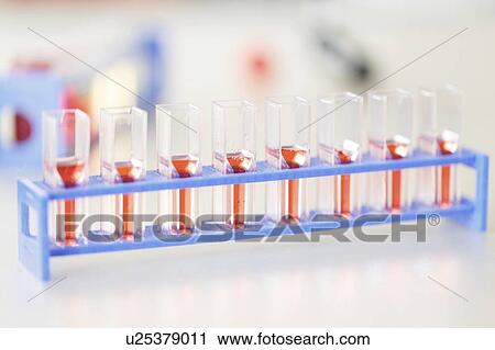 Stock Image - Cell cultures.. Fotosearch