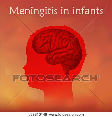 Stock Photo - Childhood meningitis, illustration. Meningitis is an acute inflammation of the protective membranes covering the brain and spinal cord.. Fotosearch