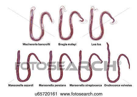 Stock Image - Comparison of microfilariae morphology. Computer illustration showing sheathed and unsheathed microfilaria worms differing also by tail nuclei location.. Fotosearch
