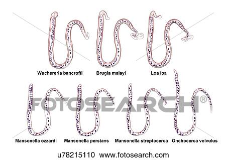 Comparison of microfilariae morphology. Computer illustration showing sheathed and unsheathed microfilaria worms differing also by tail nuclei location. View Large Photo Image Stock Image - Comparison of microfilariae morphology. Computer illustration showing sheathed and unsheathed microfilaria worms differing also by tail nuclei location.. Fotosearch