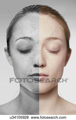 Stock Photo - Composite image of showing the damage sun exposure has done to a woman's skin.. Fotosearch