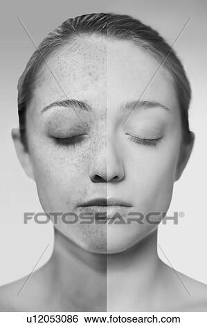 Stock Photograph - Composite image of showing the damage sun exposure has done to a woman's skin.. Fotosearch