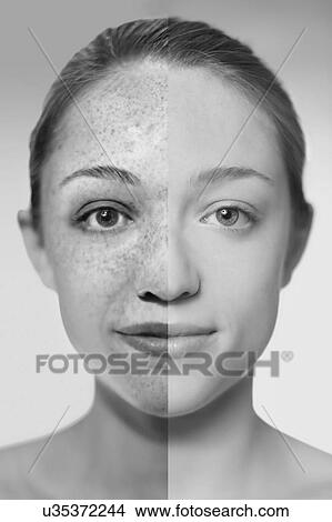 Composite image showing the damage sun exposure has done to a woman's skin. View Large Photo Image Picture - Composite image showing the damage sun exposure has done to a woman's skin.. Fotosearch