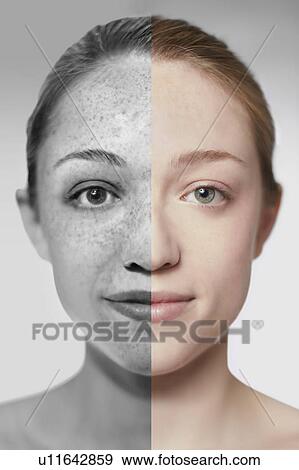 Stock Photo - Composite image showing the damage sun exposure has done to a woman's skin.. Fotosearch