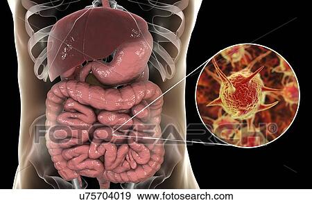 Computer illustration of abstract pathogenic microorganisms in human large intestine. View Large Photo Image Stock Photo - Computer illustration of abstract pathogenic microorganisms in human large intestine.. Fotosearch