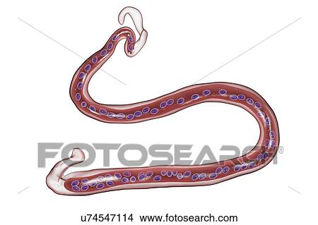 Computer illustration of Brugia malayi a parasitic nematode worm and cause of human lymphatic filariasis (elephantiasis). Brugia malayi is one of five types of nematode worm which cause human filariasis. They are spread by blood- sucking insects. The... View Large Photo Image Picture - Computer illustration of Brugia malayi a parasitic nematode worm and cause of human lymphatic filariasis (elephantiasis). Brugia malayi is one of five types of nematode worm which cause human filariasis. They are spread by blood- sucking insects. The.... Fotosearch
