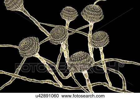 Computer illustration of fruiting bodies (conidiophores) and hyphae of the fungus Aspergillus fumigatus. A. fumigatus is a widely distributed saprophyte which grows on household dust, soil, and decaying vegetable matter, including stale food, hay and... View Large Photo Image Stock Image - Computer illustration of fruiting bodies (conidiophores) and hyphae of the fungus Aspergillus fumigatus. A. fumigatus is a widely distributed saprophyte which grows on household dust, soil, and decaying vegetable matter, including stale food, hay and.... Fotosearch