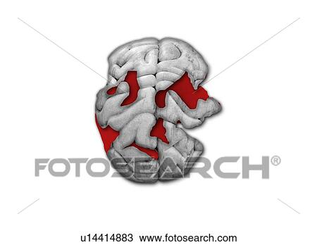 Damaged human brain, computer artwork. View Large Photo Image Stock Image - Damaged human brain, computer artwork.. Fotosearch