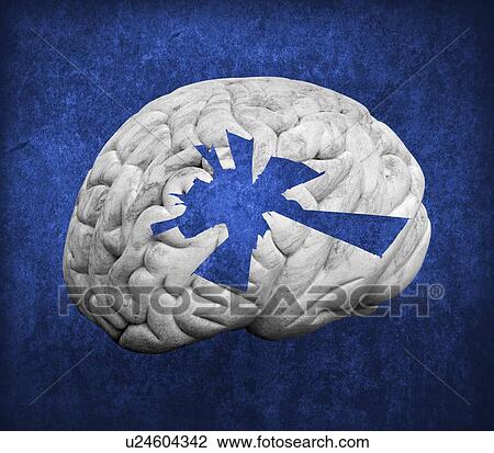 Stock Image - Damaged human brain, computer artwork.. Fotosearch