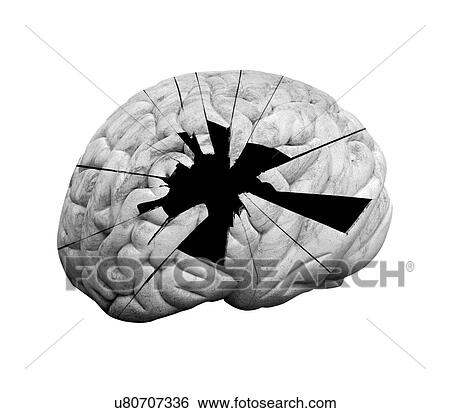Stock Photograph - Damaged human brain, computer artwork.. Fotosearch