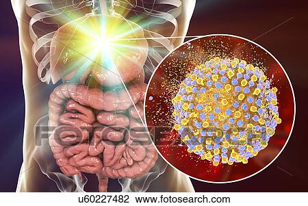 Destruction of hepatitis C virus, computer illustration. Conceptual image for hepatitis C treatment and prevention. View Large Photo Image Stock Image - Destruction of hepatitis C virus, computer illustration. Conceptual image for hepatitis C treatment and prevention.. Fotosearch