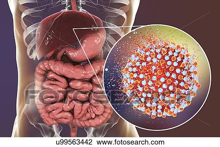 Destruction of hepatitis C virus, computer illustration. Conceptual image for hepatitis C treatment and prevention. View Large Photo Image Stock Image - Destruction of hepatitis C virus, computer illustration. Conceptual image for hepatitis C treatment and prevention.. Fotosearch