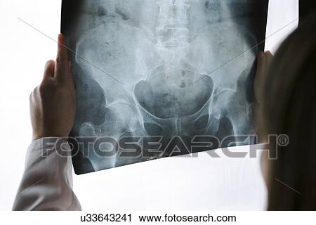 Doctor examining pelvis X-ray. View Large Photo Image Stock Image - Doctor examining pelvis X-ray.. Fotosearch