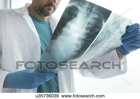 Stock Photo - Doctor examining X-ray of the human spine.. Fotosearch