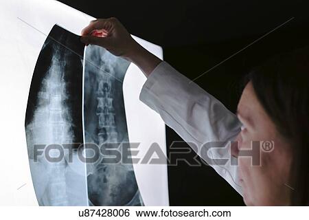 Doctor examining X-ray of the human spine. View Large Photo Image Stock Photograph - Doctor examining X-ray of the human spine.. Fotosearch