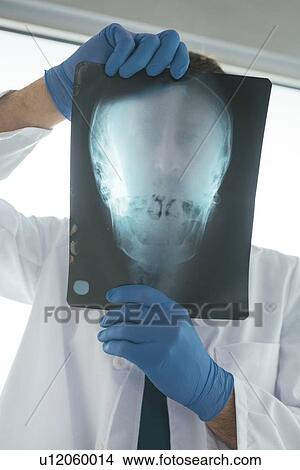 Picture - Doctor examining X-ray of the skull.. Fotosearch