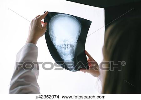 Picture - Doctor examining X-ray of the skull.. Fotosearch