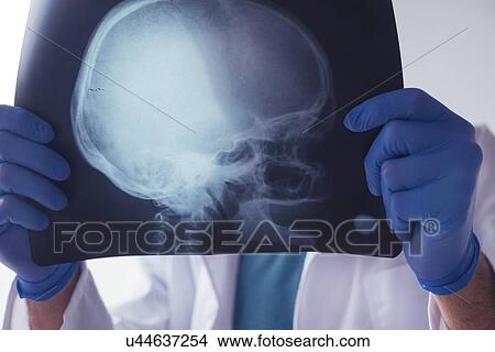 Picture - Doctor examining X-ray of the skull.. Fotosearch