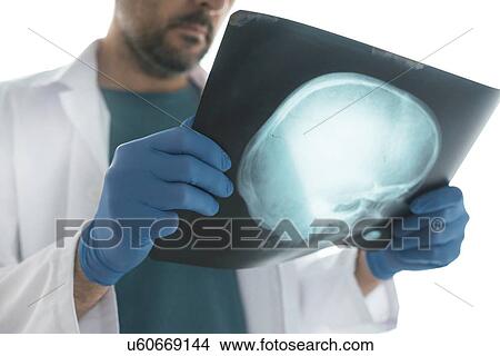 Doctor examining X-ray of the skull. View Large Photo Image Picture - Doctor examining X-ray of the skull.. Fotosearch