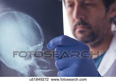 Stock Image - Doctor examining X-ray of the skull.. Fotosearch