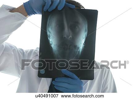 Doctor examining X-ray of the skull. View Large Photo Image Stock Photo - Doctor examining X-ray of the skull.. Fotosearch