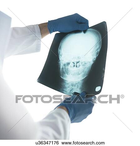 Doctor examining X-ray of the skull. View Large Photo Image Stock Photograph - Doctor examining X-ray of the skull.. Fotosearch