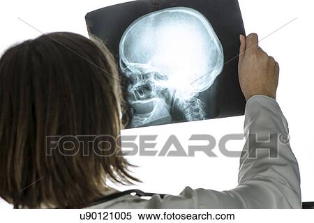 Stock Photography - Doctor examining X-ray of the skull.. Fotosearch