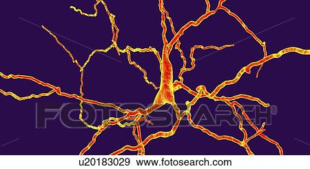 Stock Photo - Dopaminergic neuron, computer illustration. Dopaminergic neurons are brain cells whose primary neurotransmitter is dopamine. Degeneration of these cells leads to the symptoms of Parkinson's disease. These symptoms include tremor, muscular rigidity,.... Fotosearch