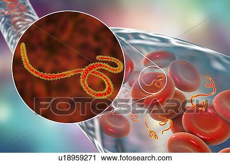 Stock Image - Ebola virus particles in blood, computer illustration. This virus is the cause of ebola virus disease in humans and nonhuman primates. It is a severe and often fatal disease with symptoms including fever, fatigue, muscle aches, vomiting, diarrhoea and.... Fotosearch