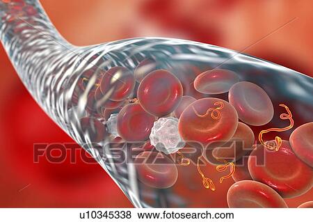 Ebola virus particles in blood, computer illustration. This virus is the cause of ebola virus disease in humans and nonhuman primates. It is a severe and often fatal disease with symptoms including fever, fatigue, muscle aches, vomiting, diarrhoea and... View Large Photo Image Stock Photo - Ebola virus particles in blood, computer illustration. This virus is the cause of ebola virus disease in humans and nonhuman primates. It is a severe and often fatal disease with symptoms including fever, fatigue, muscle aches, vomiting, diarrhoea and.... Fotosearch
