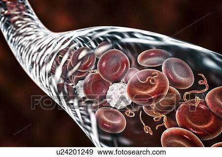 Ebola virus particles in blood, computer illustration. This virus is the cause of ebola virus disease in humans and nonhuman primates. It is a severe and often fatal disease with symptoms including fever, fatigue, muscle aches, vomiting, diarrhoea and... View Large Photo Image Stock Photo - Ebola virus particles in blood, computer illustration. This virus is the cause of ebola virus disease in humans and nonhuman primates. It is a severe and often fatal disease with symptoms including fever, fatigue, muscle aches, vomiting, diarrhoea and.... Fotosearch